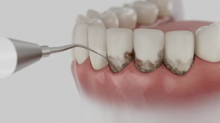 Reliable Dental contractor in Isanti, MN by Dentist Open Now